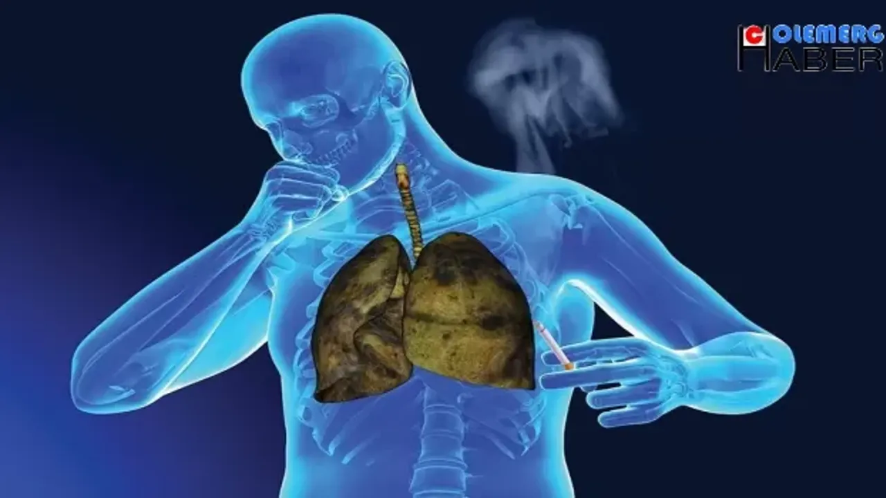 Türkiye'de Yılda 41 bin yeni akciğer kanseri teşhisi konuluyor