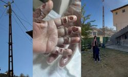 Hakkari’de Elektrik Direğine Dokunan 4 Yaşındaki Çocuk Ağır Yaralandı