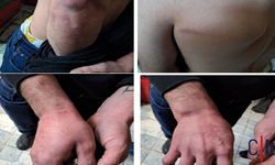 Hakkari’de hastanede Polis Şiddeti iddiası: Acile giden iki genç tutuklandı