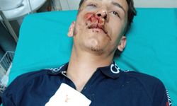 Durankaya’da Darp İddiası: Uzman Çavuş Silah Dipçiğiyle Yaraladı