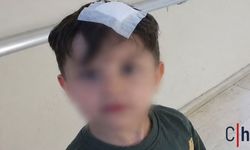 Anaokulunda Yaralanan Öğrenci İçin İhmal İddiası: Aile Suç Duyurusuna Hazırlanıyor