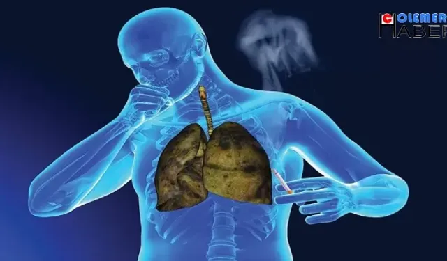 Türkiye'de Yılda 41 bin yeni akciğer kanseri teşhisi konuluyor