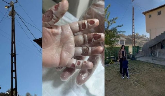Hakkari’de Elektrik Direğine Dokunan 4 Yaşındaki Çocuk Ağır Yaralandı
