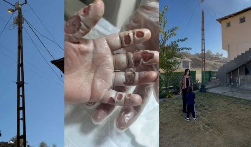 Hakkari’de Elektrik Direğine Dokunan 4 Yaşındaki Çocuk Ağır Yaralandı