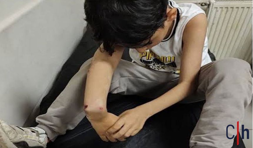 Colemêrg’de Darp Edilen 9 Yaşındaki Elyasa İçin Adalet Arayışı Başlıyor