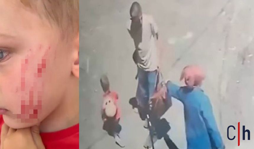 Akılalmaz Olay: Sokakta Oyun Oynayan 4 Yaşındaki Çocuğa Kadın Saldırdı!