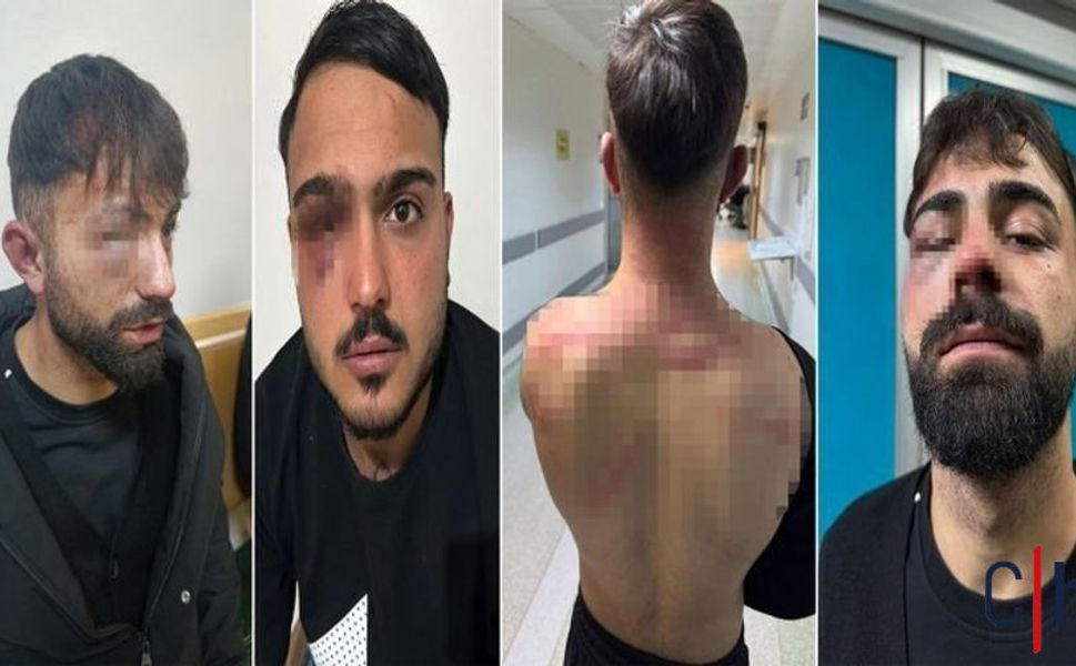 Polis Baskını ve İşkence İddiası: İki Genç Darptan Sonra Serbest Bırakıldı