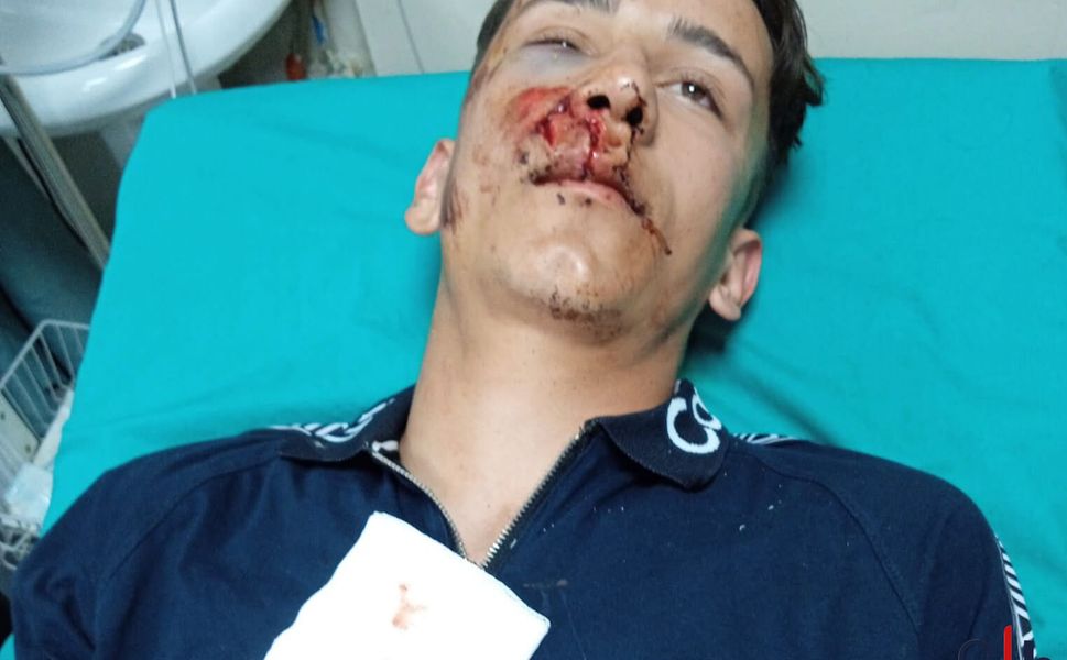 Durankaya’da Darp İddiası: Uzman Çavuş Silah Dipçiğiyle Yaraladı
